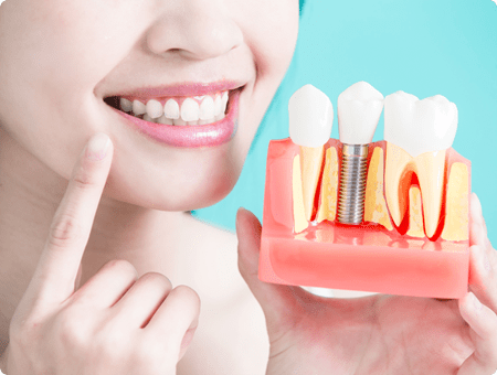 Before and After Instructions | West Calgary Periodontics