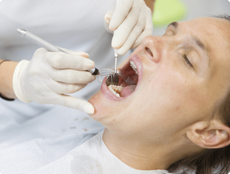 Oral Pathology | West Calgary Periodontics